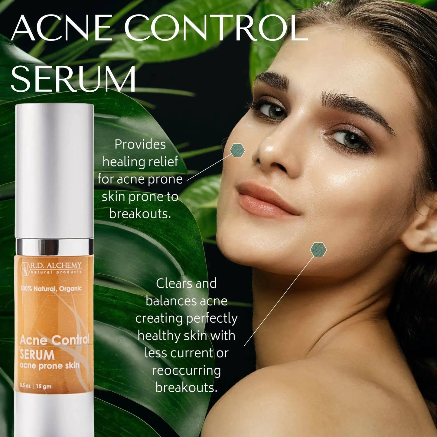 Acne Control Serum